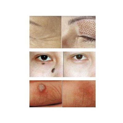 Urządzenia podnoszące - Wysyłka 1gr | EVERSUN